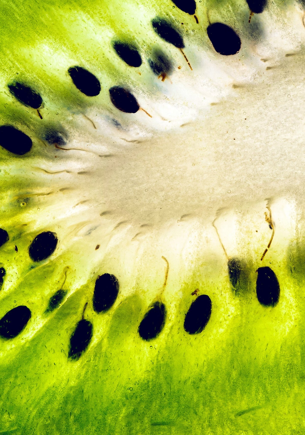 Actazin® & Livaux® Golden Kiwi